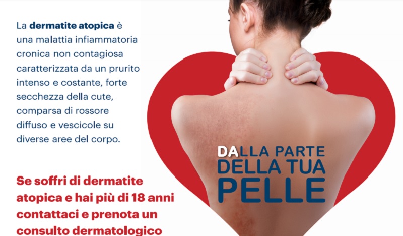 A Benevento Consulti Dermatologici presso il San Pio per chi soffre di dermatite Atopica