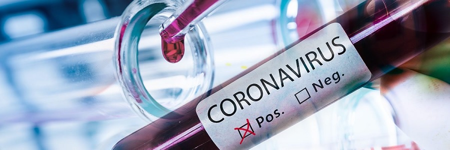 Coronavirus, dall’Olanda il primo farmaco in grado di neutralizzarlo